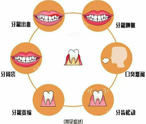 重庆做牙齿根管治疗费用多少？前牙根管500元差不多就够！