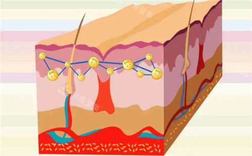 皮膚結(jié)構(gòu)剖析圖