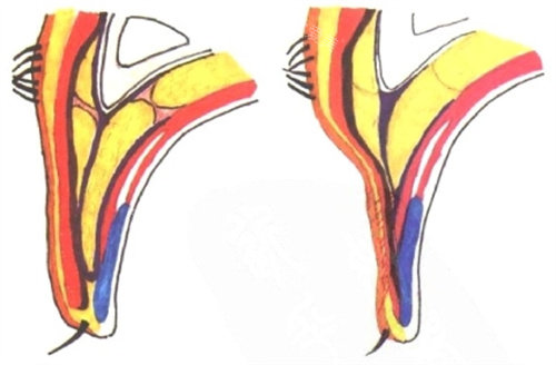 双眼皮手术前后对比图
