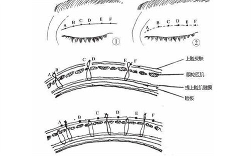 眼部縫合結(jié)構(gòu)圖