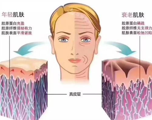 光电项目改善皮肤皱纹