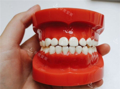 牙齒模具 牙齒模具