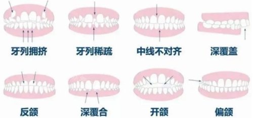 南京牙齿矫正医院排名公布，这十家牙科正畸好值得推荐！