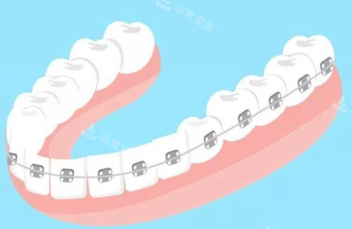 ​南京溧水瑞齿固德口腔怎么样？种植牙正畸牙贴面是特色