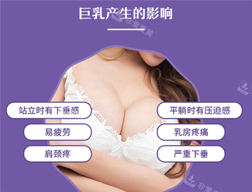 巨乳带来的影响展示