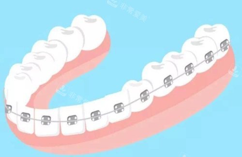 南京秦淮区牙科医院哪家好？收集正规靠谱经济实惠的牙科