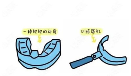 eta兒童早期矯正示意圖 eta兒童早期矯正示意圖