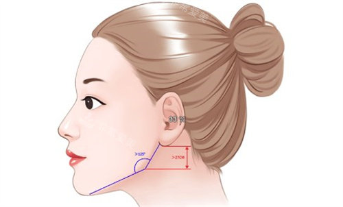 下颌角比例