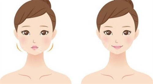 打轮廓针前后对比