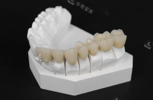 牙冠修复模具图