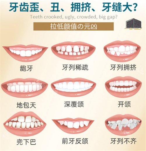 牙齿畸形图示