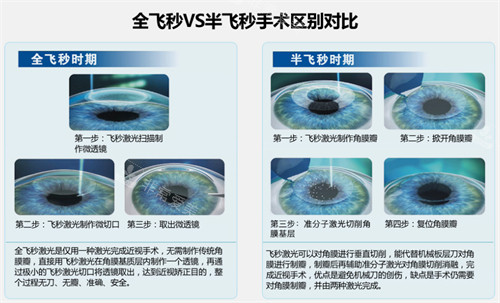 全飞秒和半飞秒手术对比图