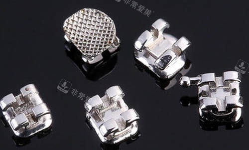 牙齒矯正托槽細節(jié)圖