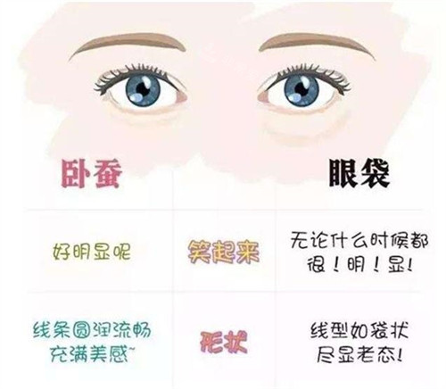 臥蠶和眼袋的區(qū)別 臥蠶和眼袋的區(qū)別