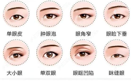 各類需要進行改善的眼睛 各類需要進行改善的眼睛