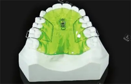 MSE扩弓器的样子图解