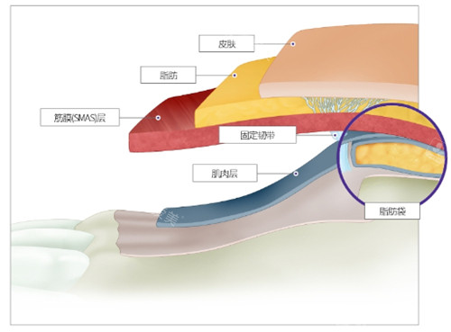 皮肤结构图示