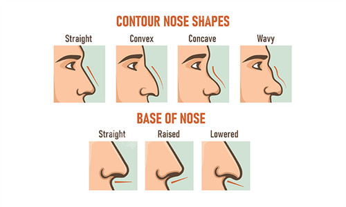 不同类型的鼻子形状