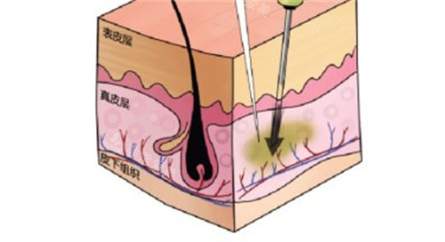 生长因子异常增长