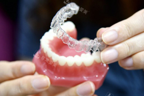 隐形牙齿矫治器的样子图解