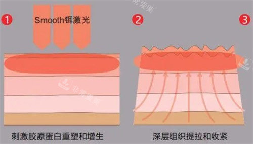 欧洲之星原理