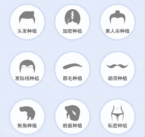 植發(fā)適應癥 植發(fā)適應癥