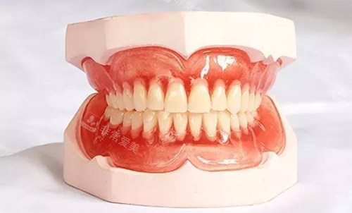 牙齿模型图示