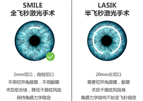 全飞秒手术和半飞秒手术切口区别