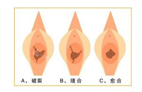 处修手术