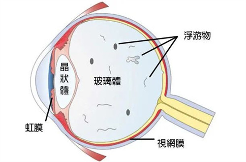 眼睛结构图示