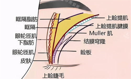 双眼皮结构图