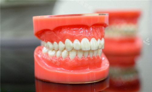 牙套模型