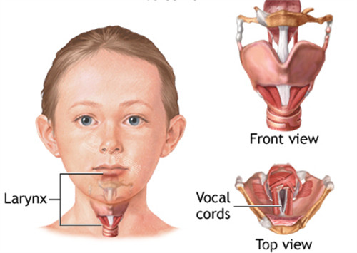 声带整形位置图解