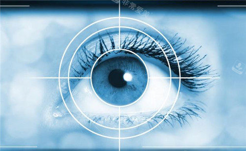 近视眼手术对焦图