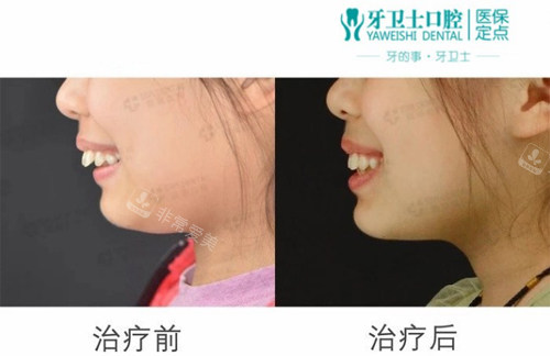南通牙卫士口腔正畸 南通牙卫士口腔正畸