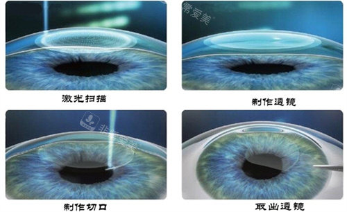 全飞秒过程图