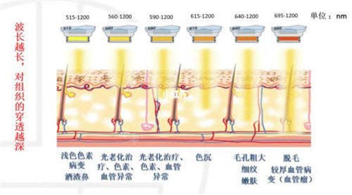 M22光子嫩膚不同波長(zhǎng)