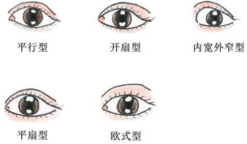 五种不同双眼皮形态图