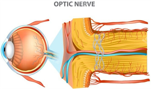 眼睛视神经萎缩表现