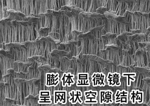 膨体的结构