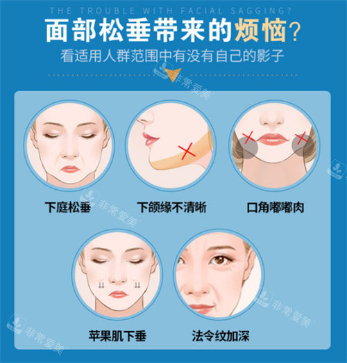 北京黄寺整形美容怎么样?面部提升拉皮手术出名且口碑好!