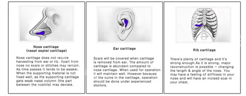 软骨鼻软骨的出处