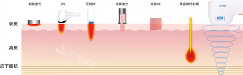 超声炮原理图