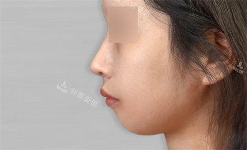 韩国macs口腔颌面外科术前照