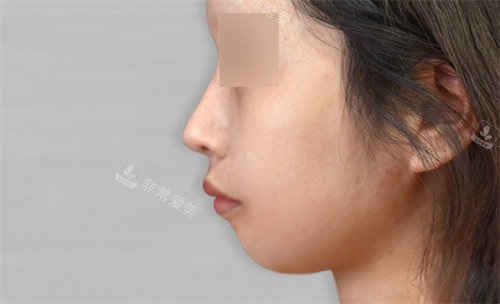 韓國macs口腔頜面外科術(shù)前照 韓國macs口腔頜面外科術(shù)前照