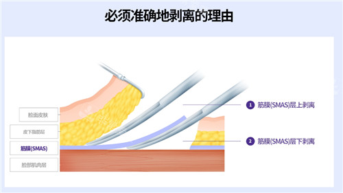 皮膚層次圖示 皮膚層次圖示