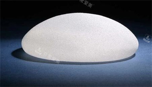 曼托假體 曼托假體