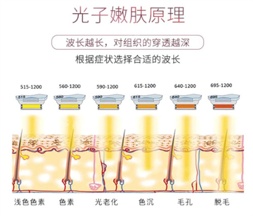 光子嫩肤的原理图解