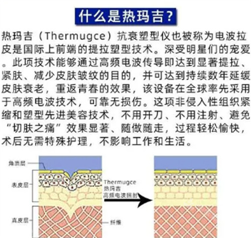 什么是熱瑪吉圖解