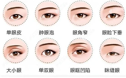 不同的眼睛